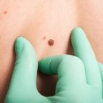 north-pacific-dermatology-skin-c
