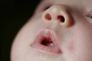 babys-mouth-and-nose